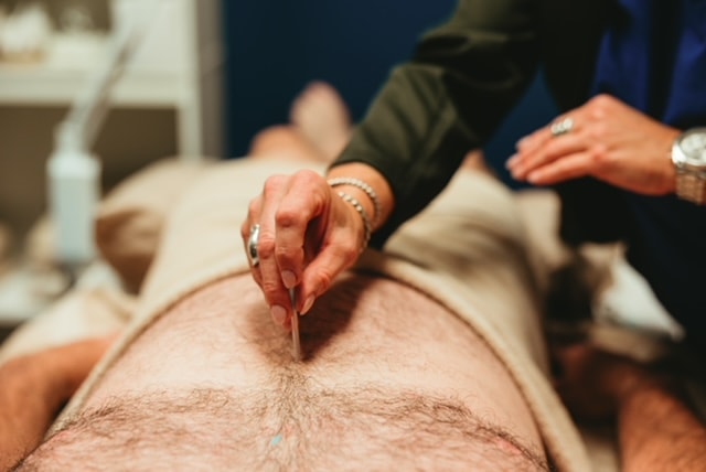 Dr. Chrestman performing full-body acupuncture treatment